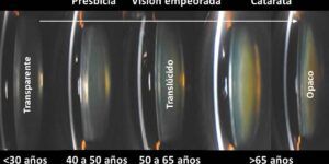 cambios en la vision a los 50 anos