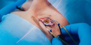 cirugia ocular lasik correccion visual