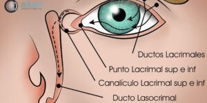condiciones oculares tratadas con cirugia