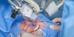 cuidado de los ojos despues de lasik