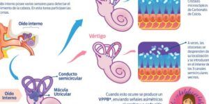 diferencias entre vertigo posicional benigno