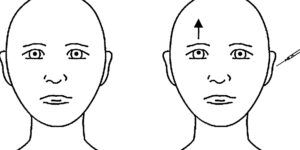 diplopia y su impacto diario