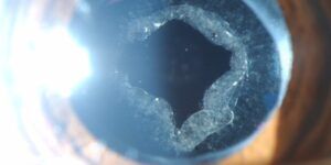 efectos secundarios de la capsulotomia