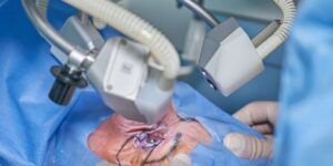 habilidades tecnicas en cirugia oftalmologica