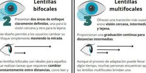 lentillas para miopia y presbicia