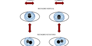movimiento involuntario de los ojos