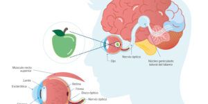 neuropatia optica sintomas causas tratamiento