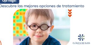 ojo vago y opciones de tratamiento