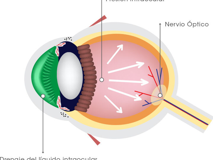 ojo y presion intraocular
