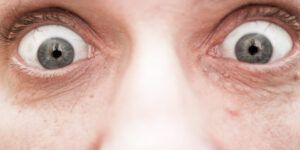 ojos de sapo en personas