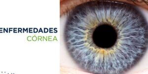 ojos deslumbrantes con colirio azul