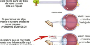 origen y causa genetica de la miopia