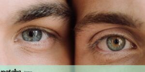 piel seca alrededor de ojos
