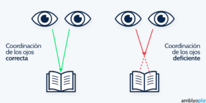 problemas de convergencia visual y tratamiento