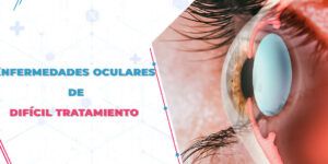 problemas visuales comunes y terapia
