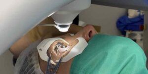 procedimiento de cirugia ocular smile