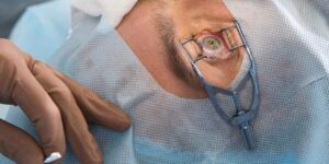 procedimiento quirurgico para tratar queratocono
