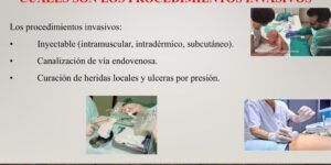 procedimientos no invasivos para salud visual