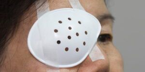 proteccion ocular despues de cirugia