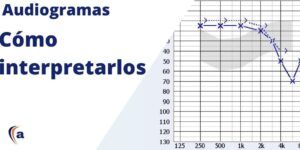 prueba de audiometria tonal e interpretacion
