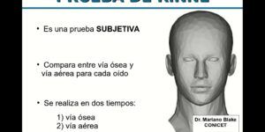 rinne positivo y su importancia