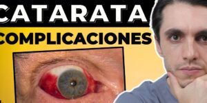 sintomas despues de operacion de cataratas