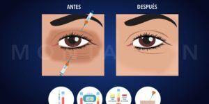 sintomas y causas de sombras negras