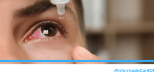 sintomas y tratamiento de conjuntivitis