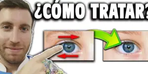 sintomas y tratamientos del nistagmo
