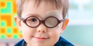 terapia de ojo vago edad limite