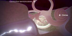 tiempo de desinflamacion del nervio vestibular