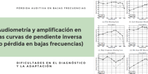 tiempo de una audiometria