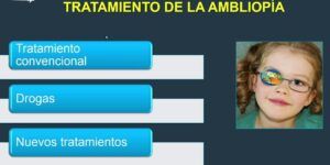tratamiento efectivo para la ambliopia
