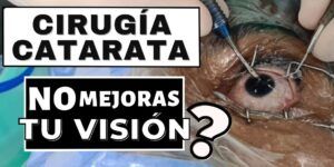 vision borrosa despues de cirugia